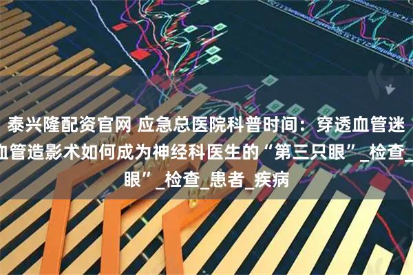 泰兴隆配资官网 应急总医院科普时间：穿透血管迷雾，全脑血管造影术如何成为神经科医生的“第三只眼”_检查_患者_疾病